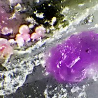 Sainfeldite, Erythrite