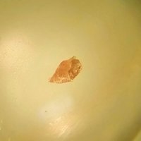 Labyrinthite