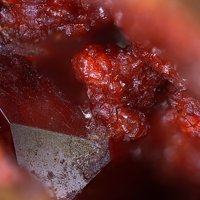 Cassedanneite, Crocoite