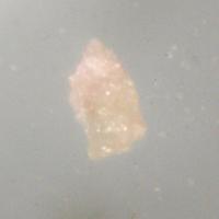 Carbokentbrooksite