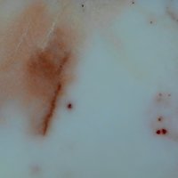 Datolite